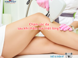 Chăm sóc da sau khi thẩm mỹ triệt lông?